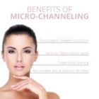Benefit of Microchanneling